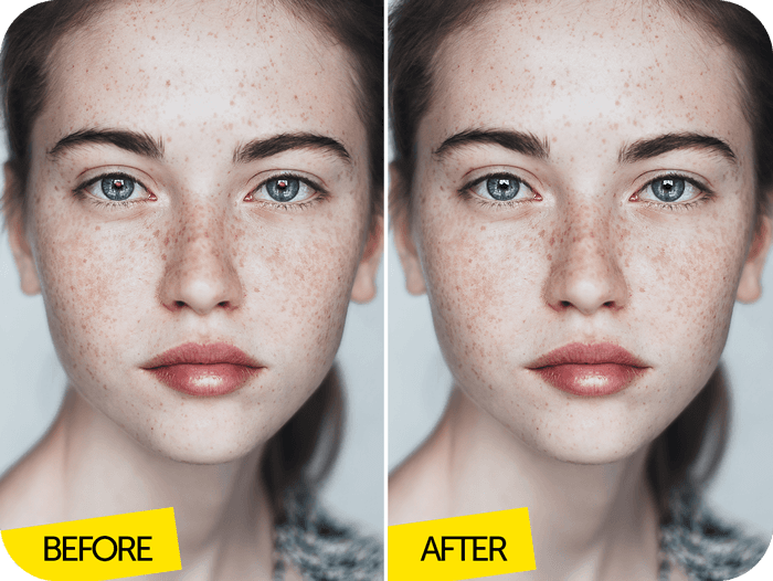 freckles girl before after Image